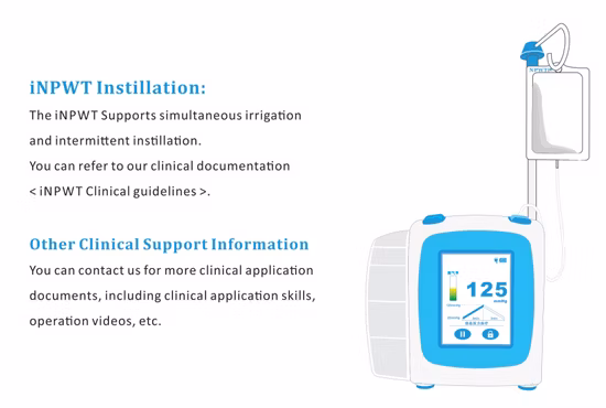 Производство портативных устройств для лечения ран отрицательного давления Npwt Насос Npwt